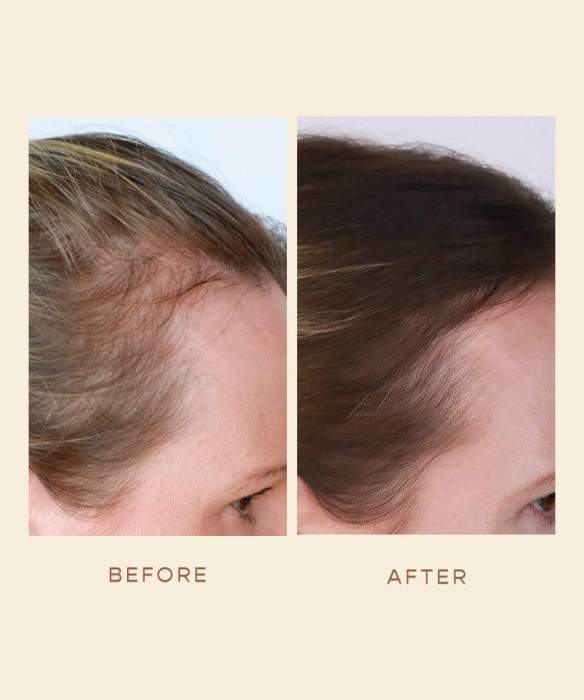 PURE BEAUTY - The Ultimate Hair Growth Oil