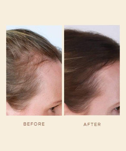 PURE BEAUTY - The Ultimate Hair Growth Oil
